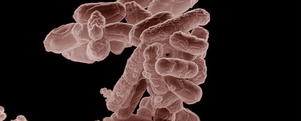 A deadly outbreak of the E. coli bacterium has claimed several victims in Germany, authorities confirmed Tuesday. A life-threatening form of the bacteria E. coli has spread across much of Germany, with scores of patients seriously ill in hospital. The bug claimed its first victim over the weekend, health officials confirmed Tuesday. The deaths follow reports that at least 140 people had fallen ill after becoming infected over recent weeks. Health officials said an 83-year-old woman from...